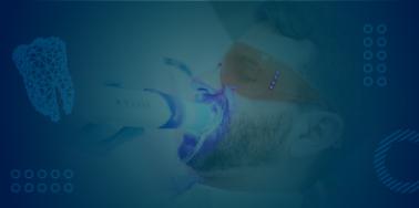 Teeth Whitening, in office